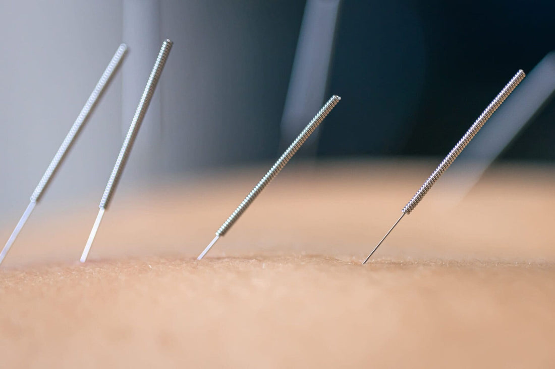 Digital Acupuncture